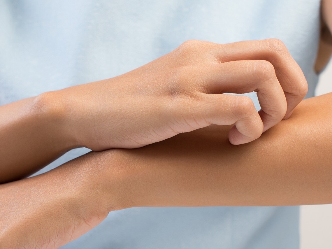 Tekstschrijver werkelijk Rouwen Last van jeuk | Bepanthen