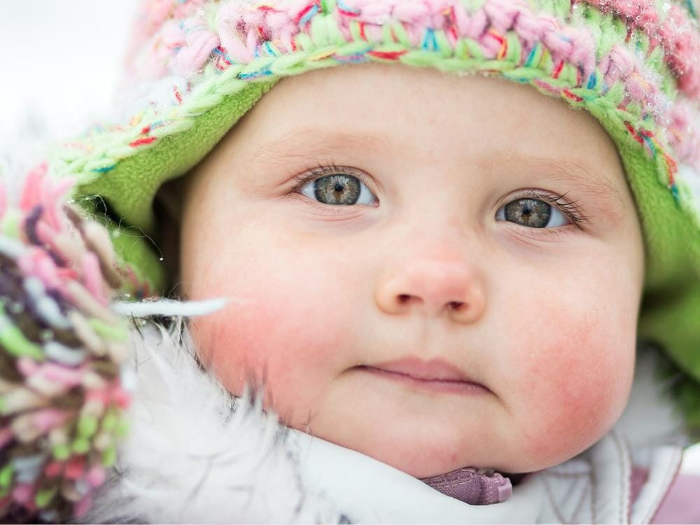 Kauwgom ademen Interpretatie Droge huid bij baby's | Bepanthen